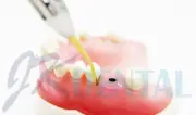 3pcs. Dental Scaler Montana Jack Double End dental hygiene instrument