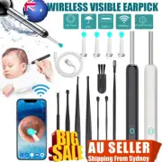 HD WiFi Smart Wireless Endoscope Visual Otoscope Ear Wax Cleaner Removal ToVZ
