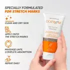 Advanced Stretch Mark Removal Cream with Natural Brazilian Ingredients