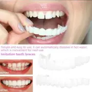 Teeth Smile Cosmetic Dentistry Snap On Instant Comfort Fit Flex Teeth Veneers