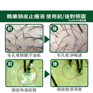 arin氧潤 頭皮止癢水 頭皮水涼感 頭皮噴霧 養髮液 頭皮去角質 120ml 頭皮精華 頭皮水 臭油癢屑脆斷扁塌