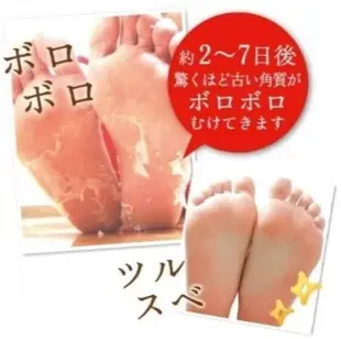 ❈花子日貨❈日本 Baby Foot 寶貝腳 去角質 3D立體 足膜 30分鐘快速版