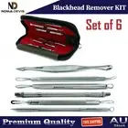 Blackhead Remover Acne Blemish Pore Cleaner Comedone Extractor Tools Kit BEADEN®