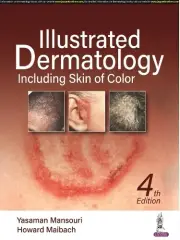 Howard Maibach Yasaman Mansouri Illustrated Dermatology (Hardback)