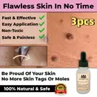 3×NEW SAFE SKIN TAG REMOVER OIL MOLE WART ACNE LIQUID PIMPLE PATCH REMOVAL SPOT