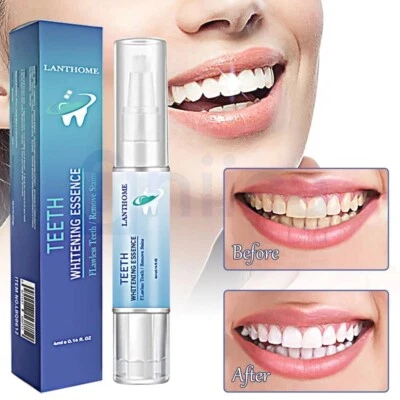 Teeth Whitening Pen Fast Safe Tooth Bleaching Gel Sensitive Teeth Easy Use Uk