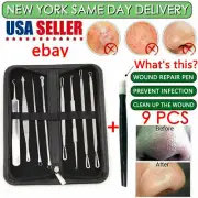 9 Pcs Kit Acne Removal Tool Kit Blackheads Whiteheads Acne Facial Extractor