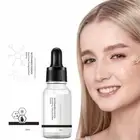 Aobenz Spot Remover Serum for Face, Freckle Essence, 1pcs