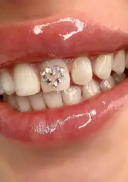 [Gemzeez] Iridescent Teeth Gemz Starter Kit