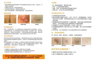 (Fe Li 飛力醫療) 適痕凝膠 (滅菌) 醫療級 疤痕凝膠(除疤/淡疤/疤痕護理/蟹足腫) (9折)