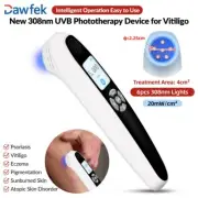 UVB Light Therapy At Home 308nm UV Phototherapy Instrument 6diodes 20mW/cm²