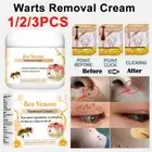 Skin Remover Tag Treatment Moisturizing Body Care Warts Removal Bee Venom Cream