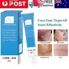 Scar removal Cream Skin Care for Scars Reduce Surgery Acne Stretch Marks 20g AU