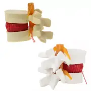 Human Lumbar Disc Herniation Spine Model 1.5X Anatomical Vertebrae Disc Model US