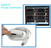 CONTEC Blood Oxygen Pulse Oximeter Spo2 PROBE PC Based Software USB interface