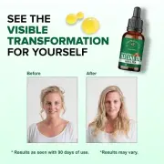 Aromatique Batana Oil - Pure Batana Oil for Hair Growth By Dr Sebi Sourced from
