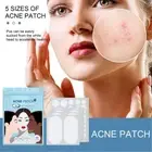 Master Ance Pimple Patches Skin Tag Remover Patch Acne Spot Treatment