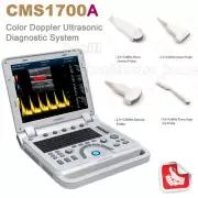 CONTEC 15"LED monitor Color Doppler Portable Ultrasound with 2 probes
