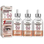 30ml Milia Remover Essential Remove Fat Particles Dark Circles Reduce Edema Eye Bags Fade Fine Lines Firming Lifting Eye Serum 3pcs