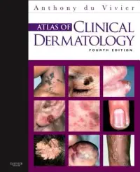 在飛比找博客來優惠-Atlas of Clinical Dermatology