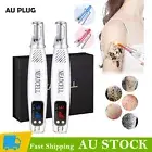 Handheld Laser Pen Tattoo Freckle Removal Machine Skin Beauty Device