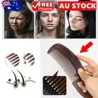 1-3X Dandruff Relief Massage Comb Anti-Itch Anti Tangling Hair Brush Hollow Comb