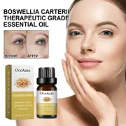 Boswellia Carterii Therapeutic Grade Essential Oil 10ml