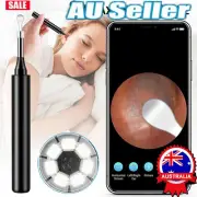 1080P Ear Wax Remover Camera Wireless Ear Endoscope Spoon Pick Cleaning Otoscope