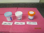 Qty (137) Sterile & Tanner Specimen Cups - Read Details