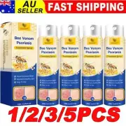 1-5x Bee Venom Psoriasis Treatment Spray Psoriasis Moisturizing Ointment Spray