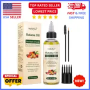 Batana Oil for Hair Growth: Dr. Sebi Organic, Thickens & Prevents Hair Loss