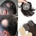 PU Skin Hairline Bald Spot Hair Patch Cover-up Frontal Remy Human Hair Hairpiece