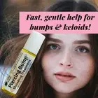 Urban ReLeaf Piercing Bump Shrinking Treatment! Aftercare Keloid Scar Cartilage