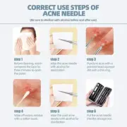 JPNK Blackhead Remover Tool Comedones Extractor Acne Removal Kit for Blemish, Wh