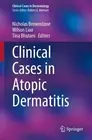 Clinical Cases in Atopic Dermatitis by Nicholas Brownstone Paperback Book