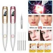Electric LCD Laser Mole Remover Pen Plasma Pen -Freckle, Spot, Wart, Tag 9 Level