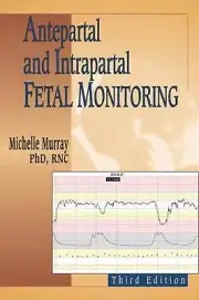 Antepartal and Intrapartal Fetal Monitoring by Michelle Murray (English) Paperba