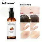 Organic Rosehip Seed Oil Rose Hips Face Oils 100ml Fast-Absorbing Skin Care GXW