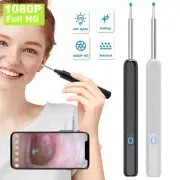 Wireless Ear Wax Remover Camera HD Ear Endoscope Spoon Pick Cleaning Tools Kit