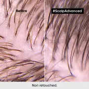 L'Oréal Professionnel Scalp Advanced Anti-Discomfort Treatment 200ml