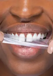 hismile PAP+ Teeth Whitening Strips (7pk)