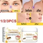 Skin Remover Tag Warts Removal Treatment Moisturizing Body Care Bee Venom Cream