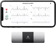 ® Kardiamobile 6L | Wireless 6-Lead ECG | Works with Smartphone | Detects Afib o