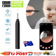 Ear Wax Removal Ear Cleaning Endoscope Spoon Mini Camera Ear Picker 1080P WZ