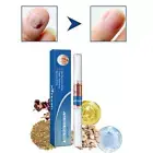 Nail Fungal Treatment Pen Anti FungusInfection Biological RepairsSolution Care