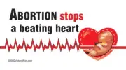 Abortion Stops a Beating Heart Pro-Life Vinyl Sign