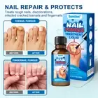20ML ​Nail Fungus Treatment Liquid For Toenail Fungus Athletes Foot Fungi Nails