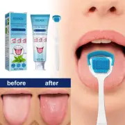 Fresh Breath Kit For Bad Breath Tongue Scraper & Cleaner with Cleaning Gel