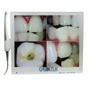 17 INCH MONITOR screen Intra Oral Camera 6-LED HD macro lens dental handpiece