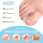 1Pair Toe Separator Hallux Valgus Corrector Overlap Adjuster Pain Relief HOT